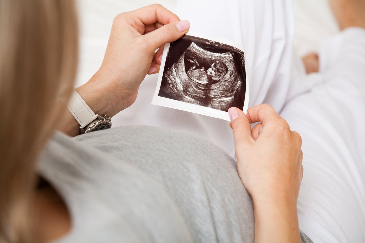 Annin, 40, lapsi on nyt kolmen kuukauden ikäinen. Kuva: Shutterstock