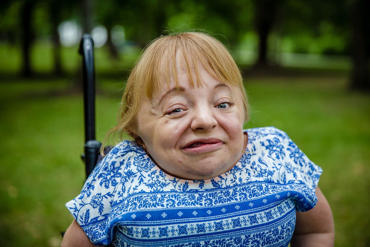 Nooralla on synnynnäinen luustonhauraussairaus osteogenesis imperfecta. Hän liikkuu pyörätuolilla, ja sairauteen liittyy myös lyhytkasvuisuus. Kuva: Liv
