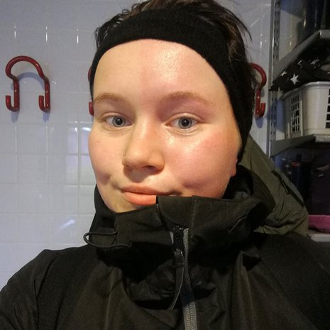 ”Olen aina ollut aika herkkä hikoilulle”, sanoo Saara Jylhä-Ollila, jonka kasvoilla hikipisaroiden lisäksi punastuminen näkyy toispuoleisena. Kuva: <span class="photographer">Saaran kotialbumi</span>